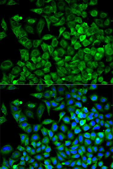 Western blot - ALDOA Polyclonal Antibody (144-01142)
