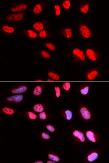 Immunofluorescence - PRPF3 Polyclonal Antibody (144-05482)
