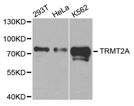 Western blot - TRMT2A antibody (144-05975)