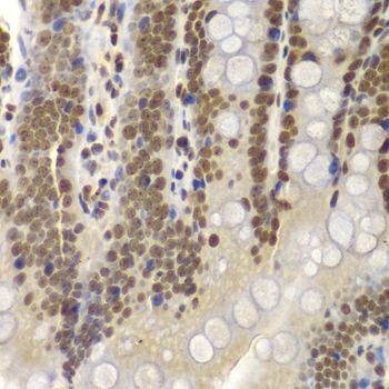 Immunohistochemistry - SMARCB1 Polyclonal Antibody (144-05767)