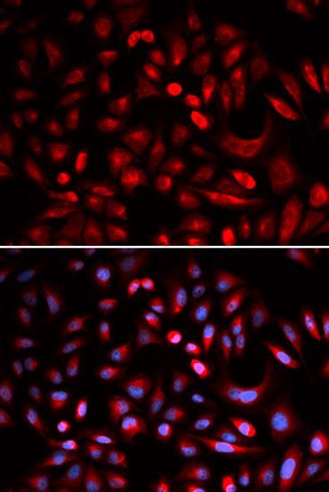 Immunofluorescence - PRKACB antibody (144-05324)