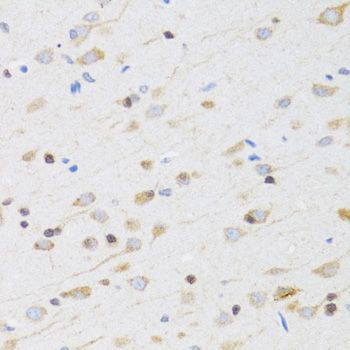 Immunohistochemistry - CHRM5 antibody (144-05367)