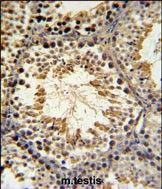 IHC-P