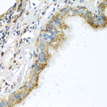 Immunohistochemistry - ATPIF1 Polyclonal Antibody (144-05099)