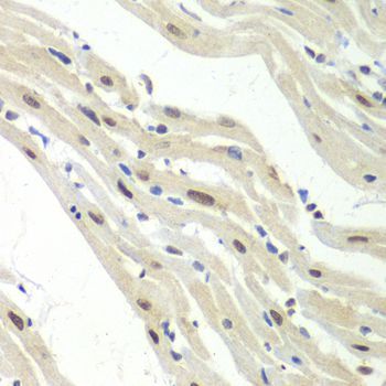 Immunohistochemistry - UPF1 antibody (144-013541)