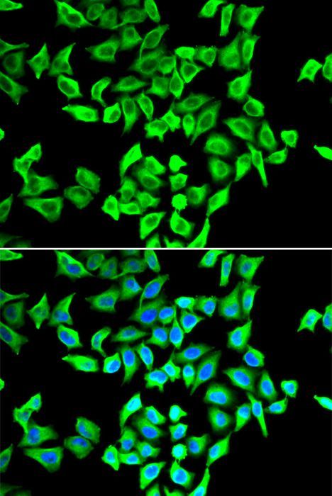Immunofluorescence - TP53 Polyclonal Antibody (144-00263)
