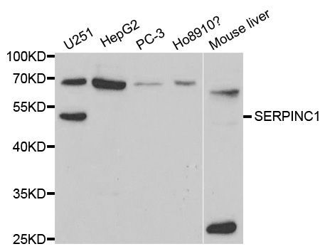 Western blot - SERPINC1 Polyclonal Antibody (144-01574)
