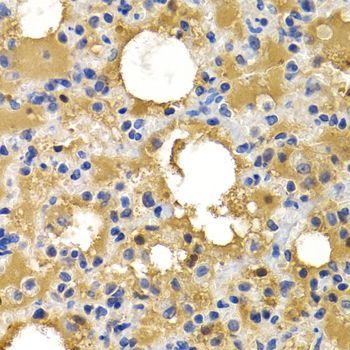 Immunohistochemistry - HSPB8 antibody (144-02514)