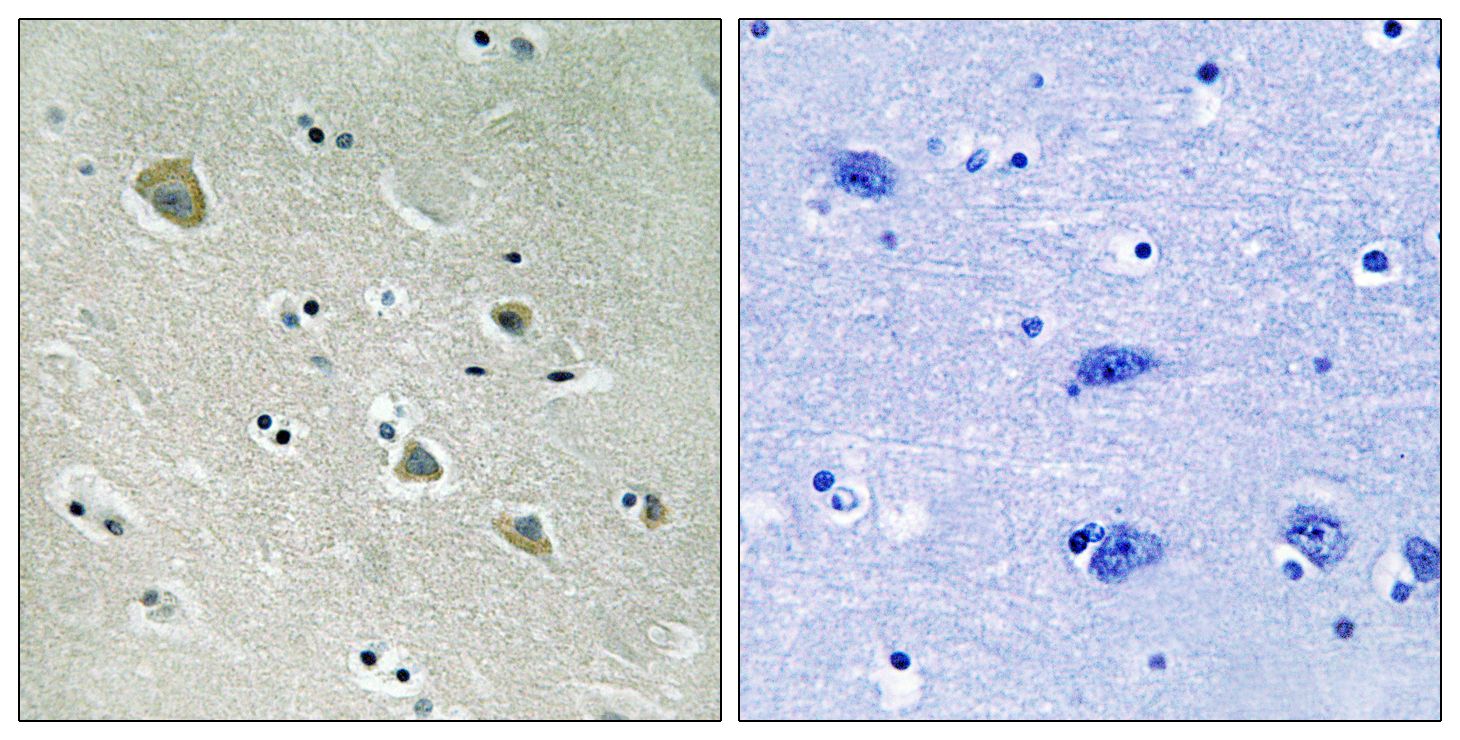 IHC