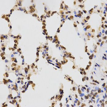 Immunohistochemistry - TriMethyl-Histone H3-K9 antibody (144-02360)