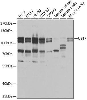 Western blot