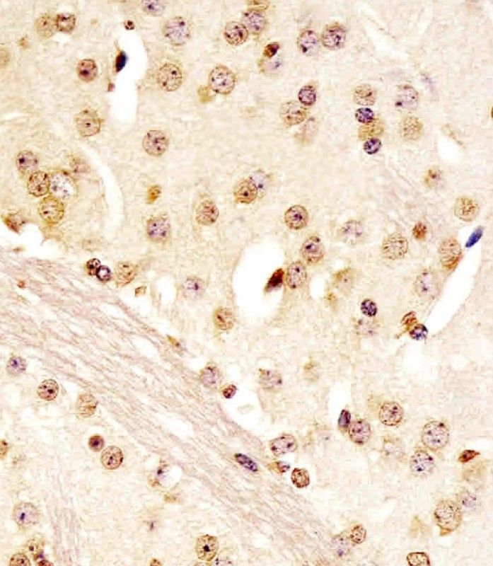IHC-P