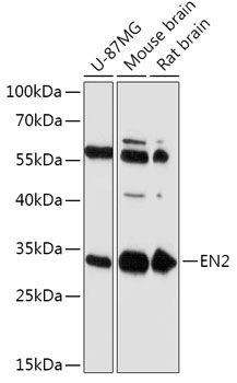 Western blot