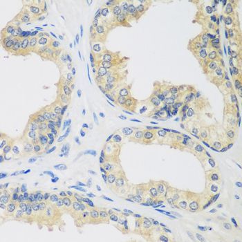 Immunohistochemistry - UPF2 antibody (144-07091)