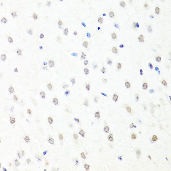 Immunohistochemistry - CHRAC1 antibody (144-07372)