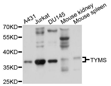 Western blot - TYMS Polyclonal Antibody (144-010441)