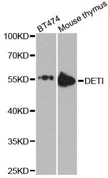 Western blot - DET1 antibody (144-09974)