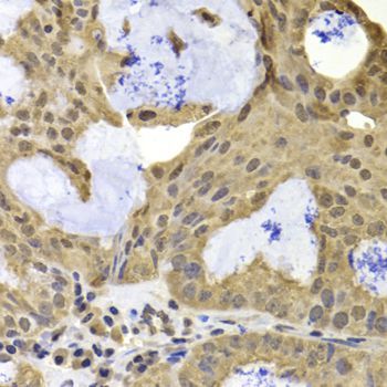 Immunohistochemistry - TERF2IP Polyclonal Antibody (144-07981)