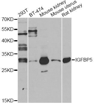 Western blot - IGFBP5 antibody (144-012451)