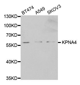 Western blot - KPNA4 antibody (144-02026)