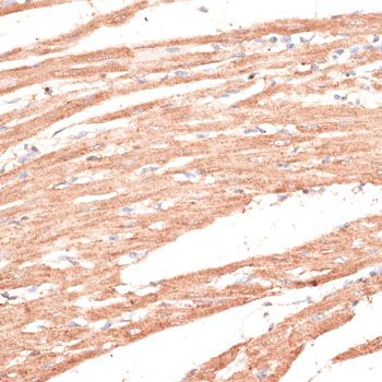 Immunohistochemistry - KIF1C antibody (144-015786)