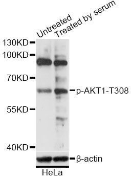 Western blot - Phospho-AKT1-T308 pAb (144-50304)