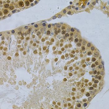 Immunohistochemistry - ELAVL1 Polyclonal Antibody (144-01608)