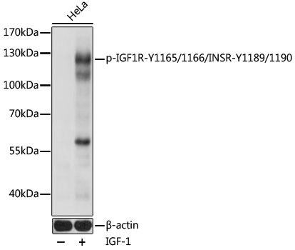 Western blot