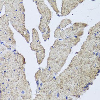 Immunohistochemistry - HBA2 antibody (144-08427)