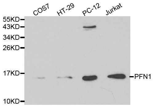 Western blot - PFN1 antibody (144-01164)