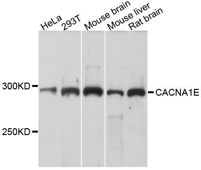 Western blot - CACNA1E Polyclonal Antibody (144-10203)