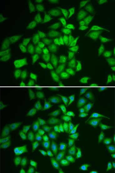 Immunohistochemistry - [KO Validated] CSNK1E Polyclonal Antibody (144-01796)