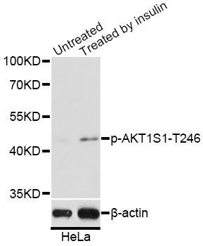 Western blot - Phospho-AKT1S1-T246 pAb (144-61523)