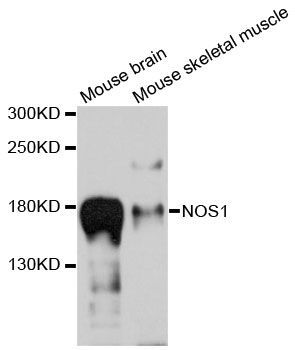 Western blot - NOS1 Polyclonal Antibody (144-12795)