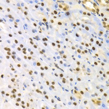 Immunohistochemistry - SFN Polyclonal Antibody (144-01026)