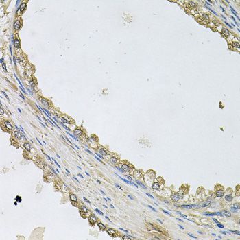 Immunohistochemistry - MTERFD1 antibody (144-09804)