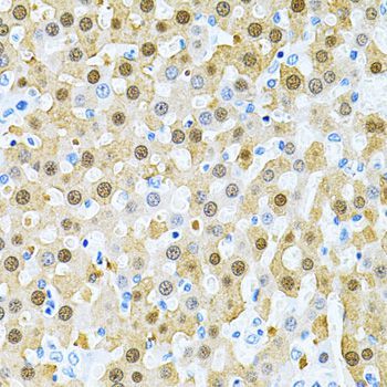 Immunohistochemistry - PIBF1 Antibody (144-03072)