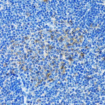 Immunohistochemistry - PAICS antibody (144-06450)