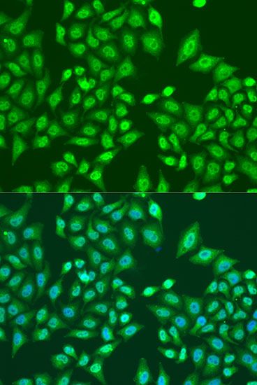 Immunofluorescence - PRPF8 Polyclonal Antibody (144-06053)