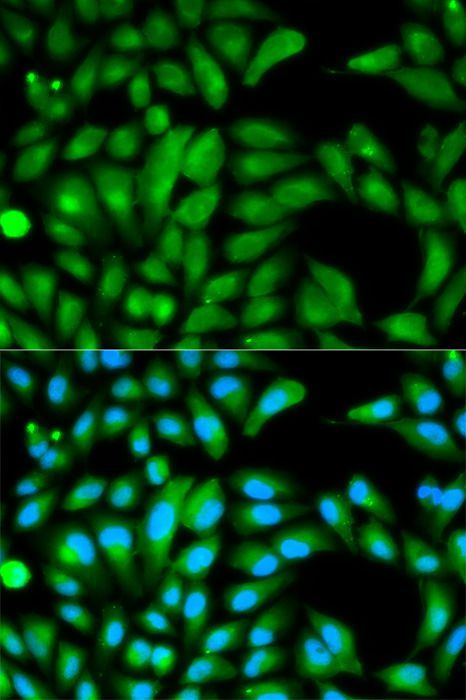 Immunofluorescence - PARK2 Polyclonal Antibody (144-00968)