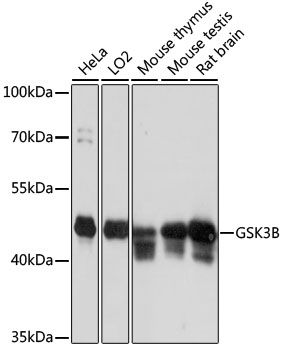 Western blot