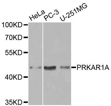 Western blot - PRKAR1A Polyclonal Antibody (144-00906)