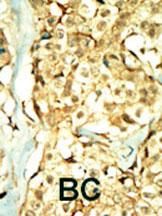 IHC-P