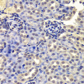 Immunohistochemistry - LSM4 Polyclonal Antibody (144-05891)