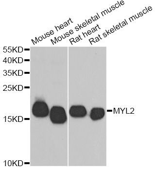 Western blot - MYL2 antibody (144-60597)