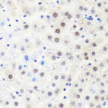 Immunohistochemistry - POLR2B Polyclonal Antibody (144-05928)