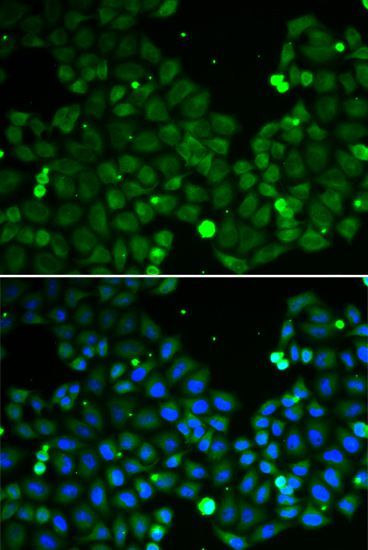 Immunoprecipitation - 1ug HIF1AN antibody (144-05466)
