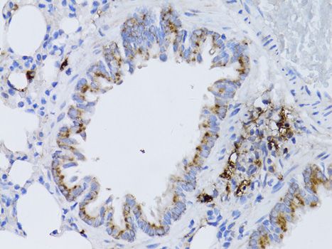 Immunohistochemistry - RARA Polyclonal Antibody (144-00370)