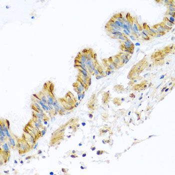 Immunohistochemistry - PCDHA12 antibody (144-08501)