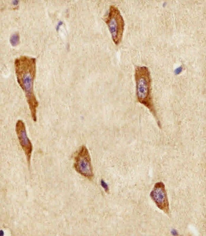 IHC-P